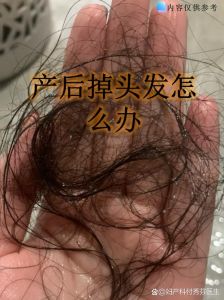 拉了头发必须要等三天吗_快速拉直，护发有讲究