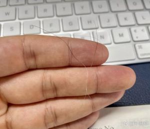 逆方向拨动头发发根痛怎么办_发根疼痛怎么办？试试这些方法！