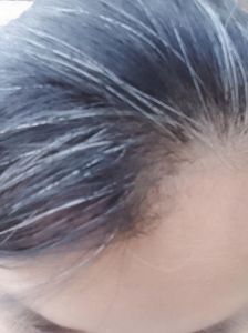 染白头发对身体有害吗_染发伤头皮？选对护健康！