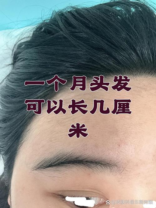 1个月头发能长2cm吗_头发生长快慢因人而异,营养遗传是关键 1个月头发能长2cm吗_头发生长快慢因人而异,营养遗传是关键
