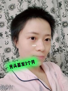 六个月头发长度对比照_六个月光头变浓密，我的护发心得分享