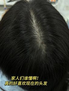 少白头还能变回黑头发吗_白发成因与调理方法