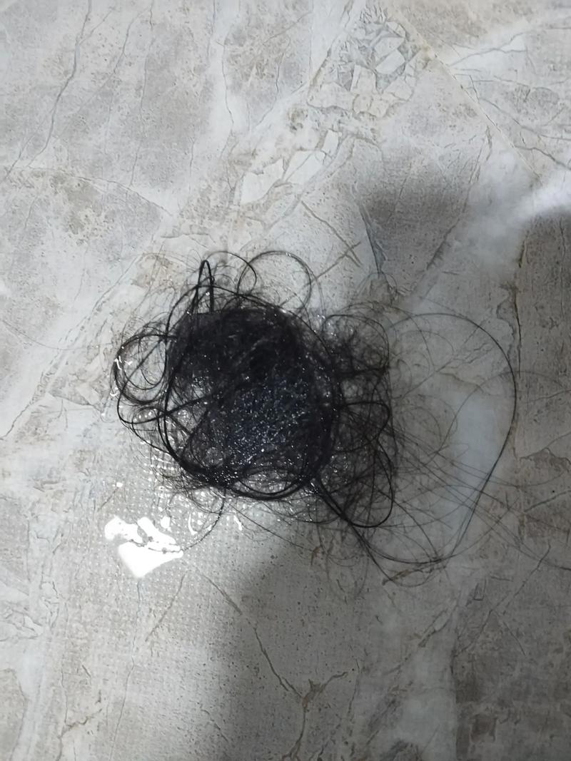 擦头发掉了而是几根头发_脱发增多？头皮痒痒？快查查！
