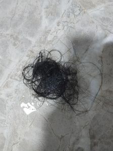 擦头发掉了而是几根头发_脱发增多？头皮痒痒？快查查！