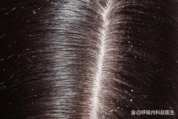 虾头发黑是重金属超标吗_虾头变黑属正常，选鲜储好更放心