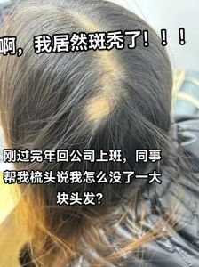 刚剃的头发2个小时就长出来了_剃刀只切断毛干，毛囊继续生长
