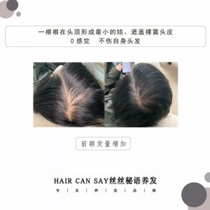 头中间头发稀少能恢复吗_头顶稀少能恢复吗？看原因！