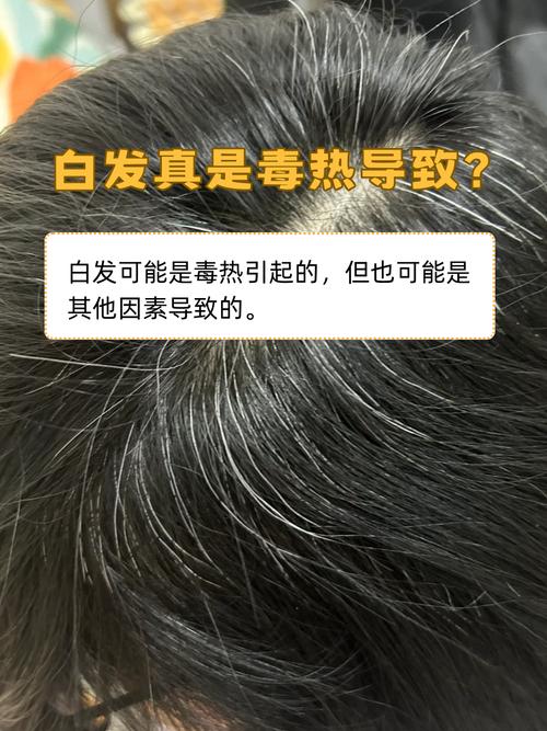 把白头发揪了会越长越多吗_拔白发没用，伤头皮还可能秃，别傻了！
