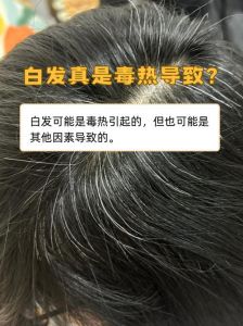 把白头发揪了会越长越多吗_拔白发没用，伤头皮还可能秃，别傻了！