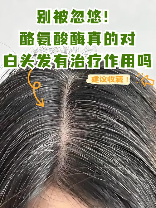 护发素对白头发有害吗_白发增多不用愁,护发素效果有限,健康饮食减压是关键 护发素对白头发有害吗_白发增多不用愁,护发素效果有限,健康饮食减压是关键