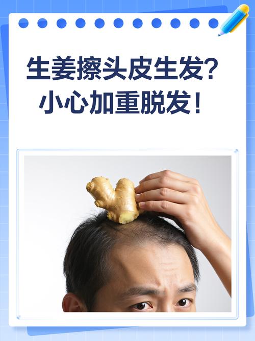 用姜擦头皮能长头发吗_生姜擦头不生发，还可能脱发，治疗脱发要找医生！