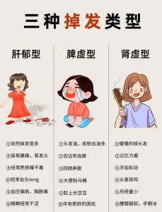 轻轻一抓头发就掉属于脱发吗_掉发增多？看这里找原因！