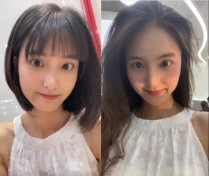 五个月头发长度对比照_头顶新发长出，坚持使用是关键