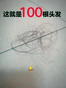 洗个头掉40根头发正常吗_掉40根头发正常吗？