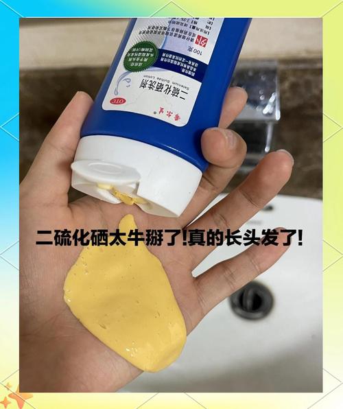 二硫化硒会掉头发吗_二硫化硒洗剂防脱生发正解用法 二硫化硒会掉头发吗_二硫化硒洗剂防脱生发正解用法