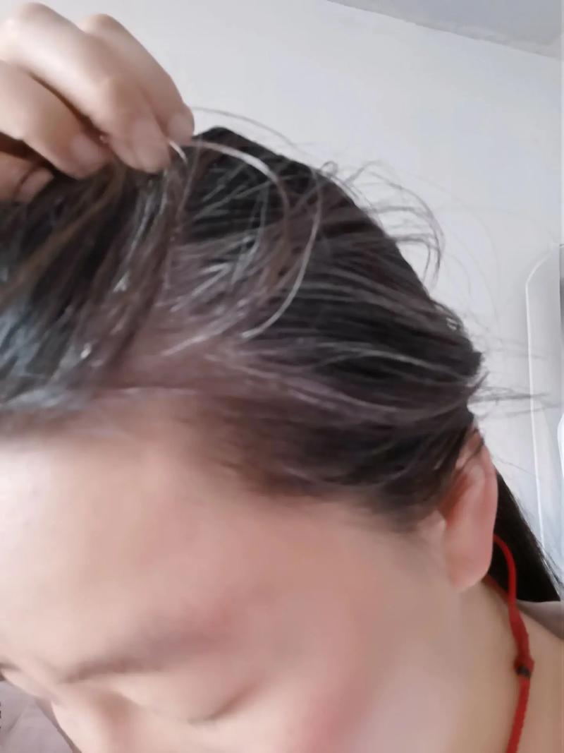 拔了一根白头发会不会长更多_别拔白发!伤毛囊,白更甚,调整生活是好方法 拔了一根白头发会不会长更多_别拔白发!伤毛囊,白更甚,调整生活是好方法