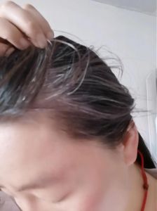 拔了一根白头发会不会长更多_别拔白发！伤毛囊，白更甚，调整生活是好方法