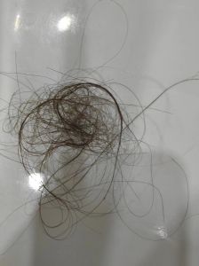 3天洗一次头掉100根头发_每天掉发50-100根是正常的