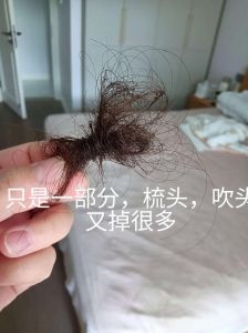 早晨一捋头发会掉很多根_梳头掉发正常，温和护理防脱发