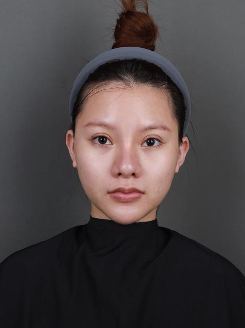 全脸填充鼻子恢复半个月可以化妆不_全脸填充鼻后恢复期及化妆注意事项