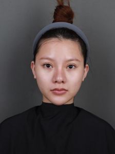 全脸填充鼻子恢复半个月可以化妆不_全脸填充鼻后恢复期及化妆注意事项