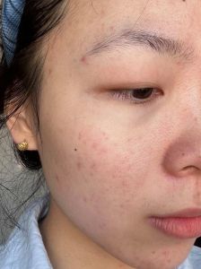 没开封的化妆品在高原会喷吗_高原化妆品易爆炸？挤空保鲜膜防喷！