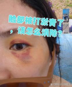 淤青用遮瑕能遮掉吗_挑对色！