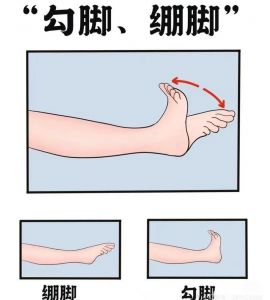 勾绷脚动作及要求_勾绷脚练好背挺直，腿松紧，膝盖并拢，协调基本功！