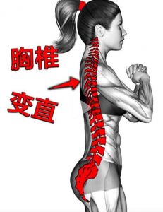 胸椎变直练瑜伽有用吗_瑜伽改善胸椎变直，恢复体态健康