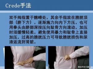 膀胱功能恢复训练方法_方法与注意事项