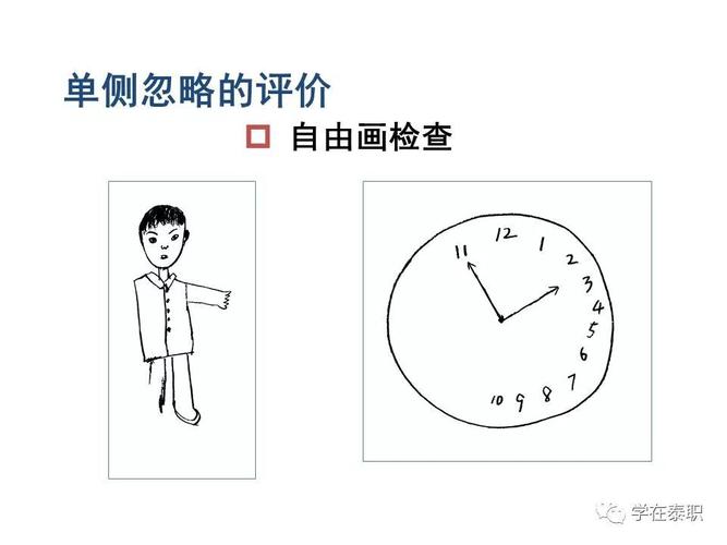 单侧忽略训练方法_脑卒中后单侧忽略,影响生活需重视 单侧忽略训练方法_脑卒中后单侧忽略,影响生活需重视