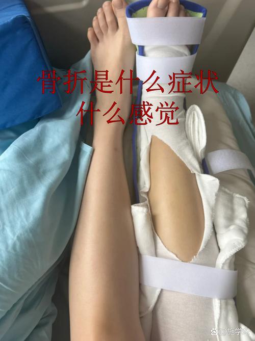 左骨冠突骨折最怕三个动作_避免发力扭转，循序渐进恢复