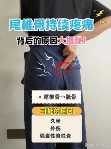 尾骨骨折最怕三个动作_注意动作 避免扭转深蹲