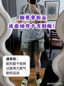 肋骨骨折最怕三个动作_避免剧烈运动，循序渐进恢复