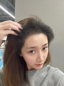 手术前能不能染头发_手术前后染发要注意！