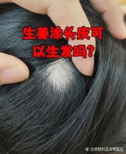 秃头用姜擦能长出头发吗_生姜擦头助生发？效果因人而异需谨慎！