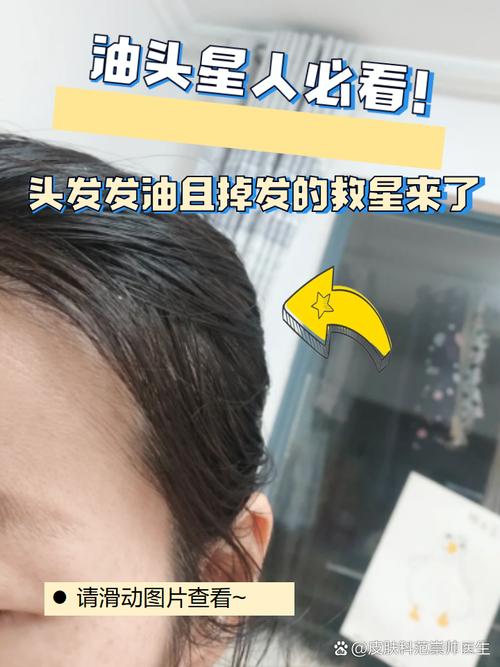 捐发之前可以把头发烫直了减吗_健康发质助病友