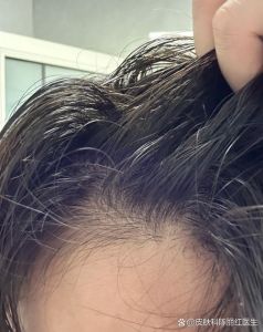 跑完800头发会油吗_运动后头发油腻？这样洗护更清爽！