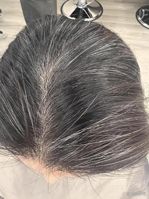 拔一根白头发长三根是真的吗_白发拔不掉，黑了还是一根