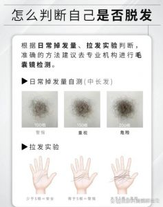 秃头长头发大概要多久_脱发能长回吗？看原因，分快慢！