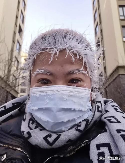 带安全帽时间久了头发少了_戴安全帽真掉头发?别信! 带安全帽时间久了头发少了_戴安全帽真掉头发?别信!