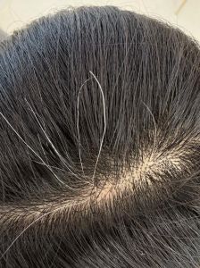 揪一根白头发会长出很多吗_别拔白发，伤毛囊还可能脱发