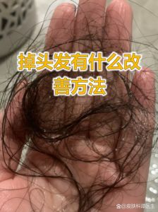 戒掉熬夜头发会长回来吗_熬夜掉发别慌，调整作息或可恢复！