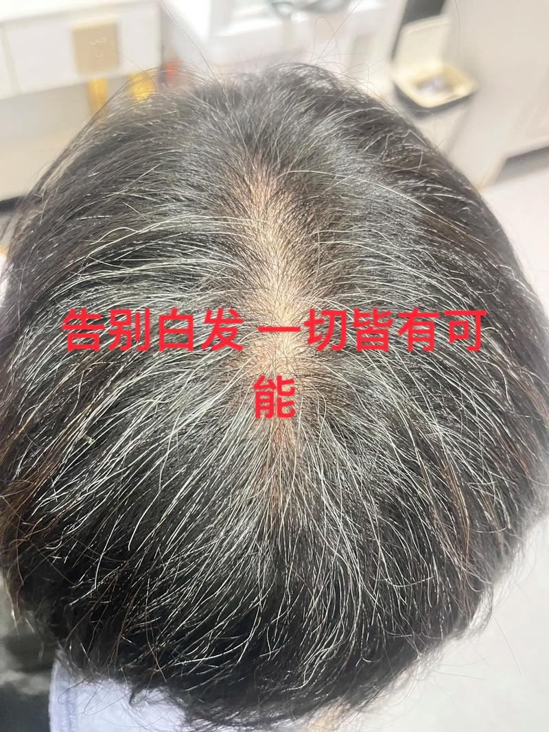 茶粉养发能把白头发变过来吗_茶粉养发效果有限,别当白发克星 茶粉养发能把白头发变过来吗_茶粉养发效果有限,别当白发克星