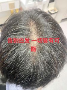 茶粉养发能把白头发变过来吗_茶粉养发效果有限，别当白发克星