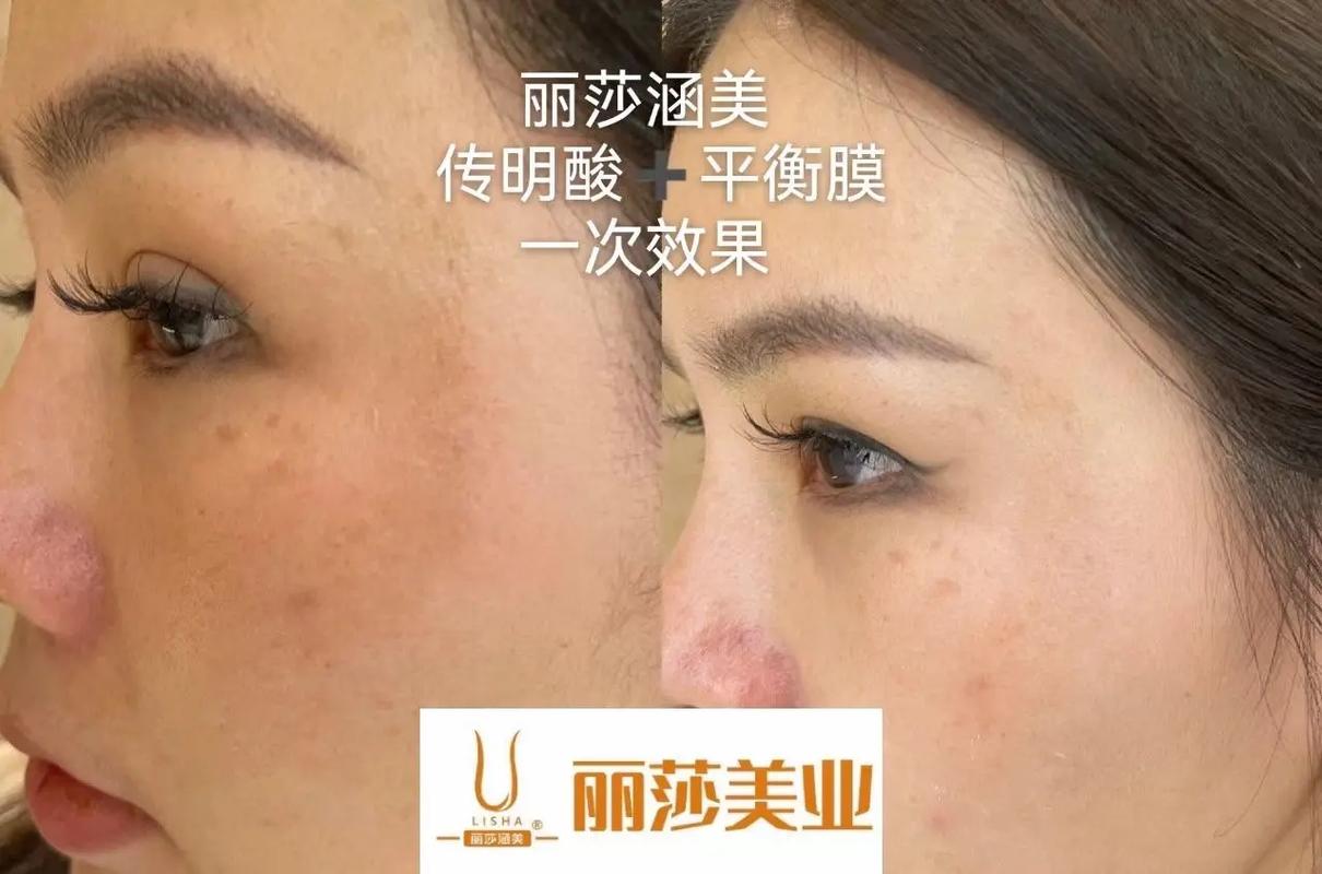 丽莎涵美化妆品怎么样_丽莎涵美白化妆品质地好，安全，但祛斑效果因人而异，是否适合需考虑