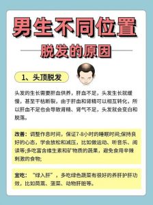 胖了就掉头发是什么原因_肥胖致脱发？遗传加剧，控制体重是关键
