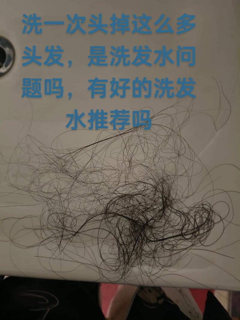 一梳头发就掉30根洗头时又掉_脱发增多?快查查原因! 一梳头发就掉30根洗头时又掉_脱发增多?快查查原因!