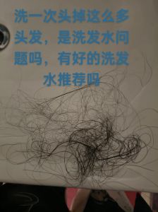一梳头发就掉30根洗头时又掉_脱发增多？快查查原因！