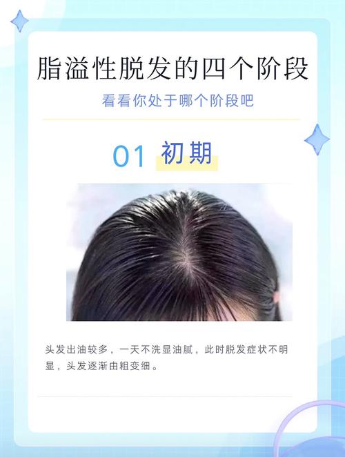 脂溢性脱发头发为什么轻轻一拉_气血养发,防脱固发小妙招 脂溢性脱发头发为什么轻轻一拉_气血养发,防脱固发小妙招